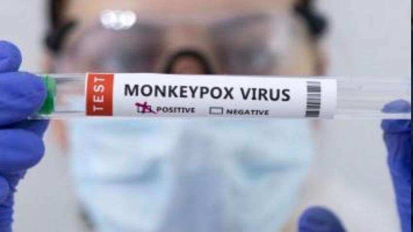 Monkeypox in Delhi: दिल्ली में मंकीपॉक्स वायरस का एक और शिकार, धीरे-धीरे  बढ़ रहे हैं मामले | Zee Business Hindi