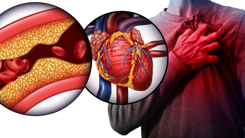 हाइपरटेंशन की बीमारी है एक साइलेंट किलर, बचाव के लिए इन बातों का रखें ख्याल