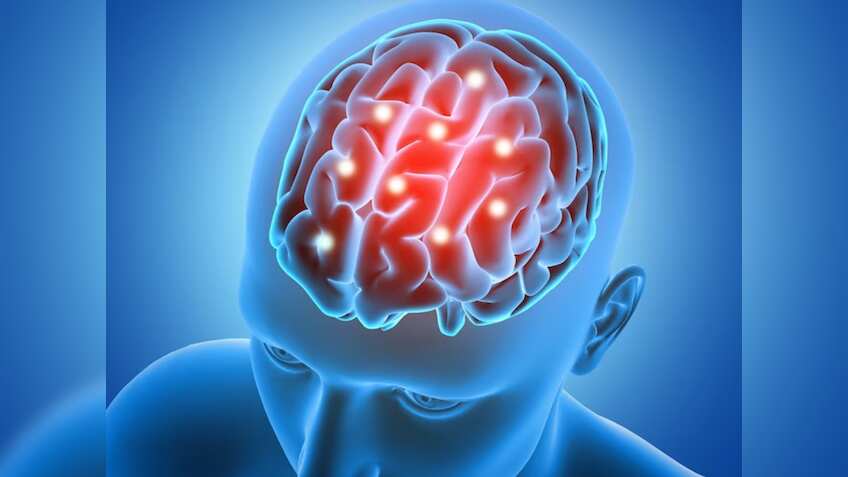 World Brain Tumor Day 2023: क्‍यों मनाया जाता है वर्ल्‍ड ब्रेन ट्यूमर डे, जानिए इसका महत्‍व और इतिहास