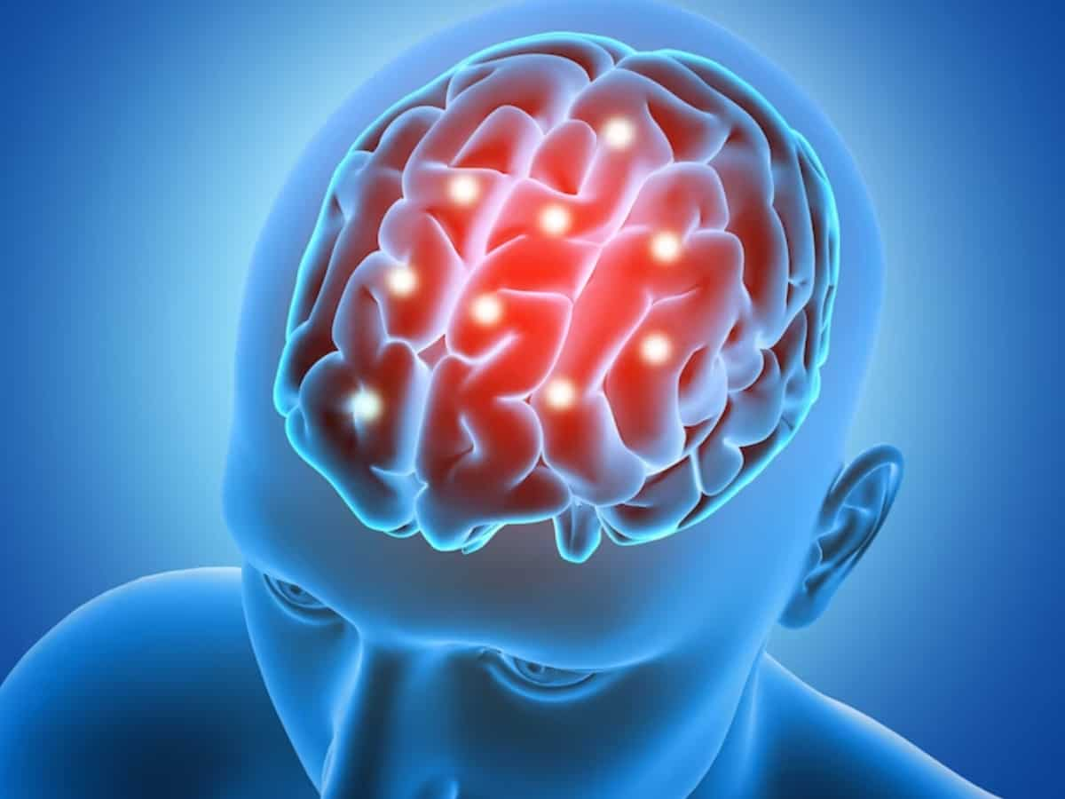 World Brain Tumor Day 2023: क्‍यों मनाया जाता है वर्ल्‍ड ब्रेन ट्यूमर डे, जानिए इसका महत्‍व और इतिहास