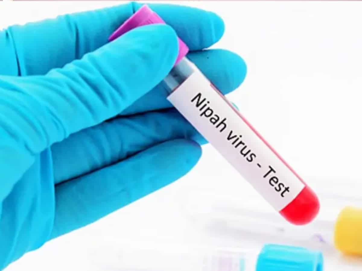 Nipah Virus: निपाह पर ICMR का अलर्ट, कोविड से भी ज्‍यादा घातक है ये बीमारी, जानिए इससे जुड़ी जरूरी जानकारी