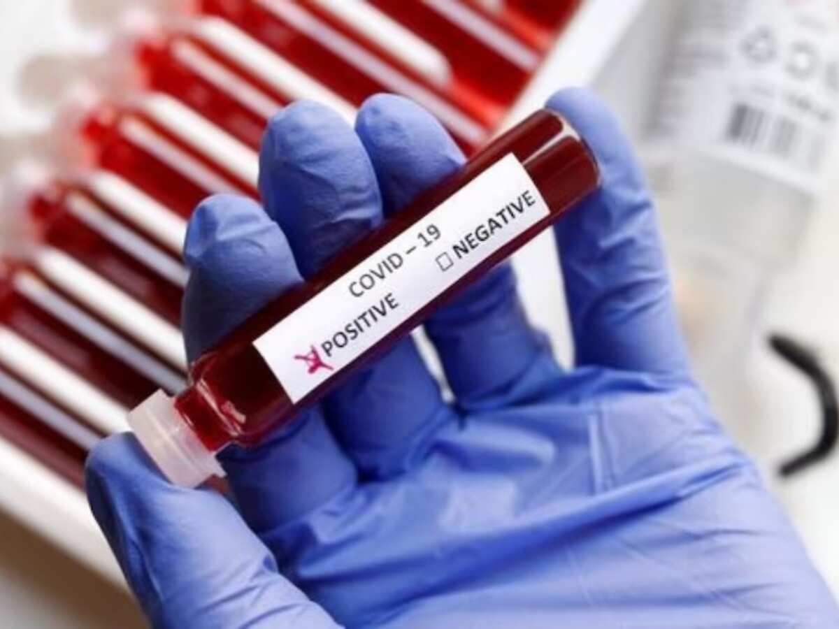 Covid-19 Update: देश में 24 घंटे में कोरोना के 441 नए मामले, किसी की मौत नहीं, यहां चेक करें लेटेस्ट अपडेट