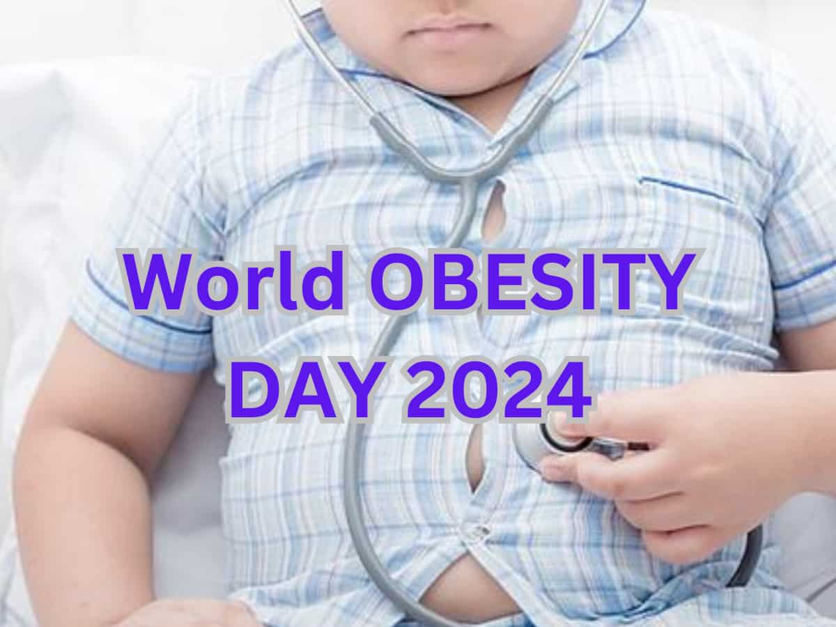 World Obesity Day 2024: वर्ल्ड ओबेसिटी डे आज, 1 अरब से ज्यादा लोग मोटापे का शिकार, इन बीमारियों का खतरा