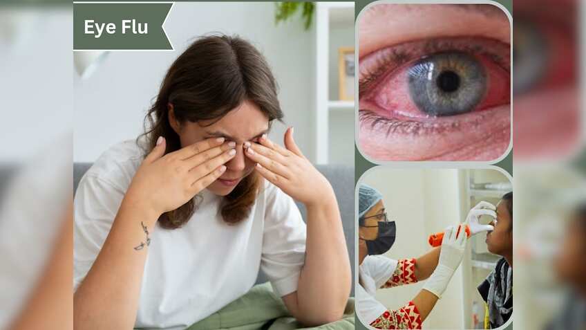 Eye Flu: आ गया लाल आंखों वाली बीमारी कंजंक्टिवाइटिस का मौसम, समझें ...