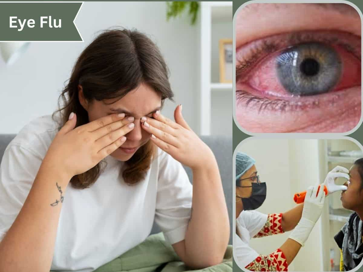 Eye Flu: आ गया लाल आंखों वाली बीमारी कंजंक्टिवाइटिस का मौसम, समझें लक्षण और इस संक्रामक रोग से बचाव के तरीके