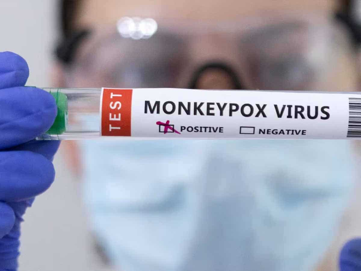 Monkey Pox पर सरकार हुई अलर्ट, पीएम के प्रमुख सचिव ने लिया तैयारियों का जायजा, दिए ये निर्देश