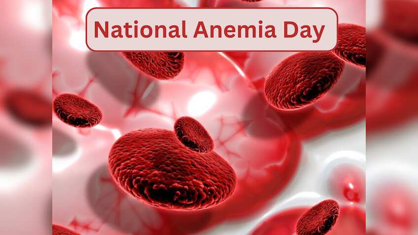 National Anemia Day 2025: खाने के बाद पीते हैं चाय तो आज से सुधार लें ये आदत, हेल्‍थ एक्‍सपर्ट ने दी ये हिदायत