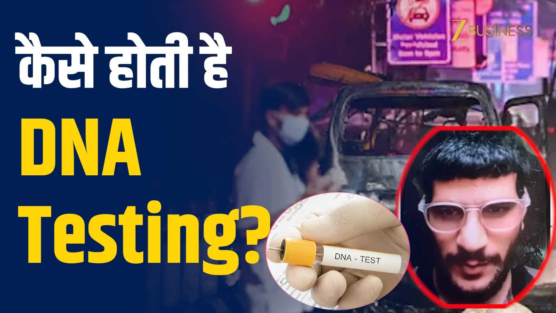 Delhi Blast: DNA टेस्ट में ऐसे हुई उमर की पहचान, समझें फंडा!