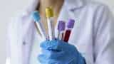 Covid-19 india update: Assam lab isolates Coronavirus, Ready to make Corona vaccine