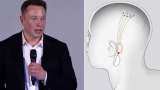 future Elon Musk human brain chip plan, Neuralink developing brain implant computer microchips human test