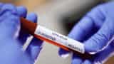 Delhi government:CM Arvind Kejriwal: rates of RT PCR tests be reduced in Delhi. ,