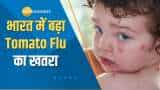 Aapki Khabar Aapka Fayda: क्या है Tomato Flu? जानिए लक्षण और बचाव के उपाय