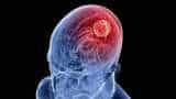 What is brain dead or brain stem death its cause and hope of survival know expert opinion