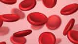 Now sickle cell disease can be treated world's cheapest medicine has been created Health Minister congratulated