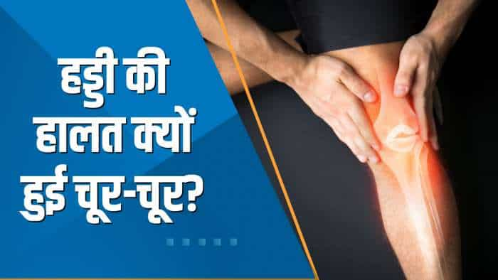 Aapki Khabar Aapka Fayda: हड्डी की हालत क्यों हुई चूर-चूर? देखिए ये खास रिपोर्ट | World Osteoporosis Day