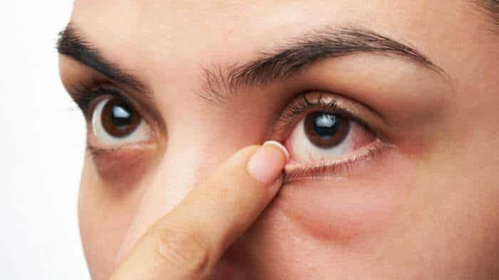 diabetes eye problems