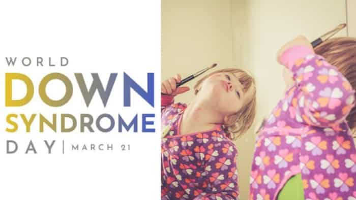 World Down Syndrome Day WDSD Date significance trisomy 21 genetic disease reason symptoms and precautions