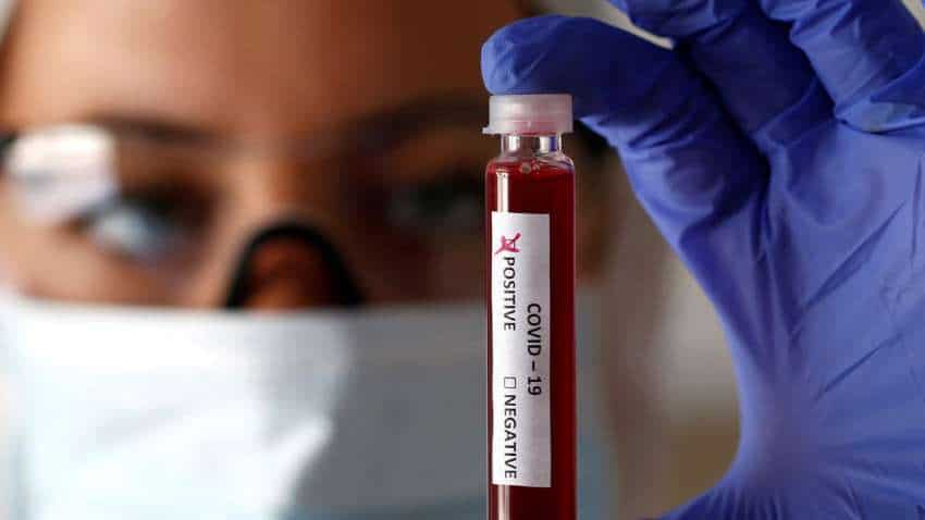 दिल्ली में 21 लैब में महामारी कोरोना की टेस्टिंग शुरू, जानिए पूरी डिटेल यहां
