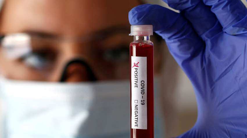 कोरोना वायरस का जल्‍द मिल सकेगा इलाज, दवा का दूसरा परीक्षण शुरू