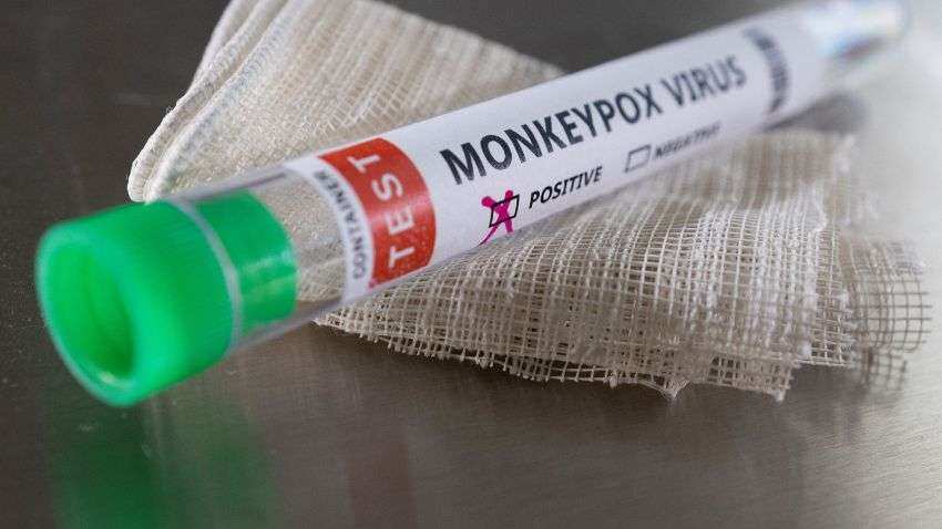 Monkeypox Virus को लेकर अलर्ट मोड में सरकार, टेस्टिंग किट और वैक्सीन बनाने के लिए निकाला टेंडर