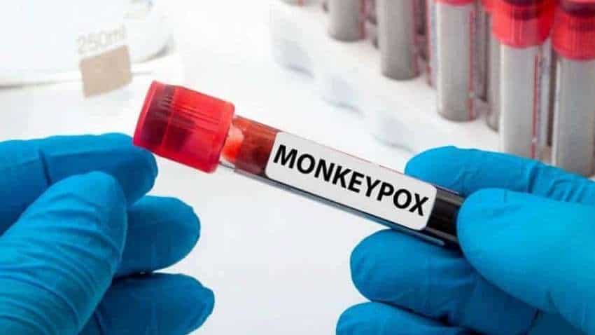 Monkeypox in India: राहत की खबर!देश का पहला मंकी पॉक्स मरीज हो गया स्वस्थ, अस्पताल से छुट्टी आज