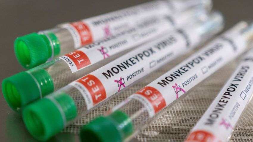 Monkeypox Vaccine: देश में बनने जा रही मंकीपॉक्स की वैक्सीन, अदार पूनावाला ने बताया सीरम इंस्टीट्यूट की क्या है तैयारी