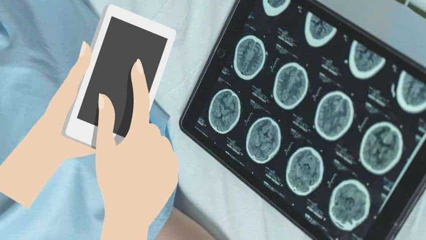 मोबाइल यूज करने से Brain Stroke के मरीजों के लिए खतरा कम होता है? ICMR की ये नई स्टडी पढ़िए 