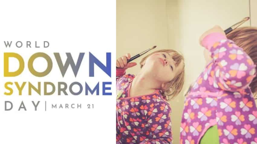 World Down Syndrome Day: 'ट्राइसोमी 21' के नाम से भी जाना जाता है डाउन सिंड्रोम, जानें इस दिन का महत्‍व और बीमारी के लक्षण 