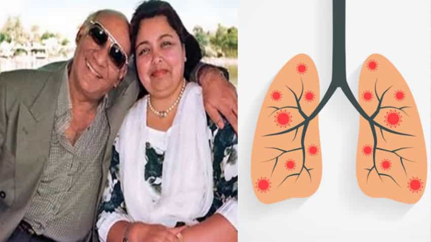 Pamela Chopra Death Reason: ARDS के चलते हुई पामेला चोपड़ा की मौत, बेहद खतरनाक मेडिकल कंडीशन है ये