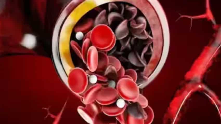Sickle Cell Anaemia से निपटने के लिए FDA ने रोगियों के इलाज के लिए जीन थेरेपी को दी मंजूरी