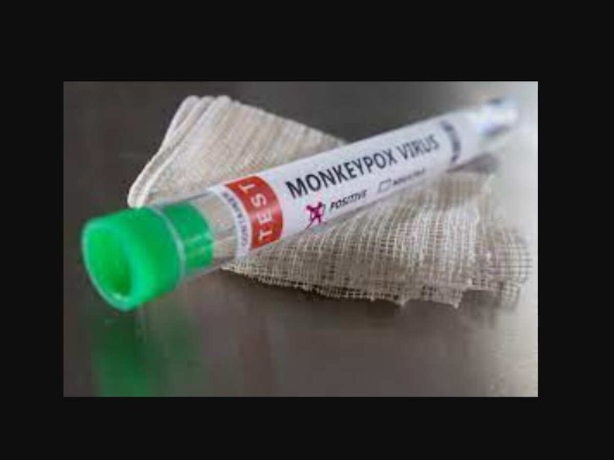Kerala monkeypox death: 22-year-old man becomes first victim;
