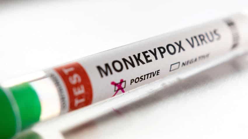 Monkeypox vaccine update: Which country will get it first? World's biggest vaccine maker SSI's boss Adar Poonawalla speaks