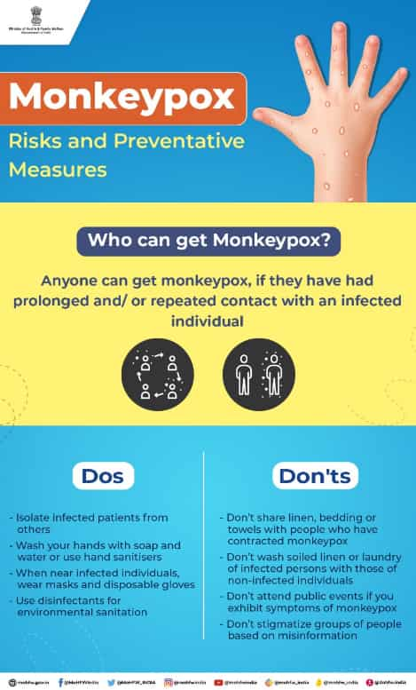 Monkeypox disease: Health Ministry issues dos and don'ts to arrest ...