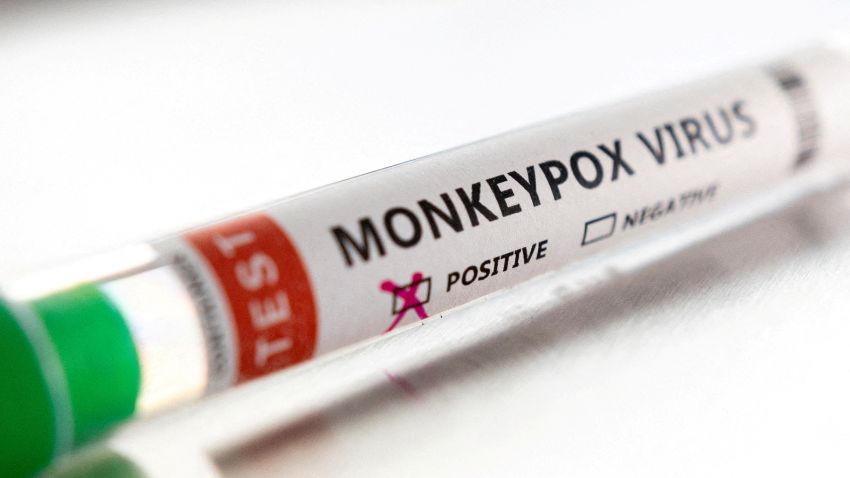 Monkeypox declared public health emergency in US as cases spiral