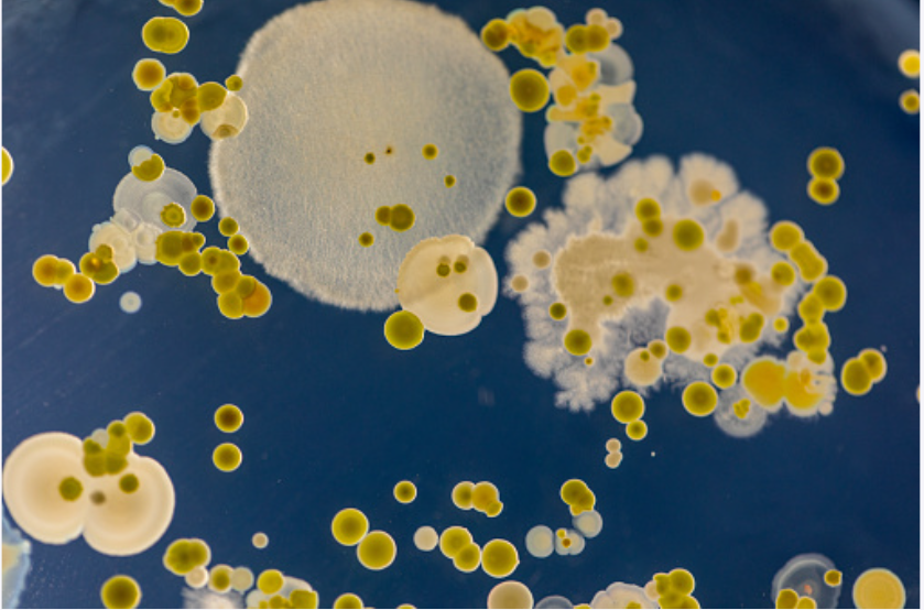 Bacterial enzyme that turns air into electricity discovered