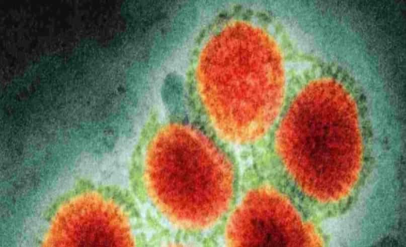 WHO reports first death from H3N8 virus in China