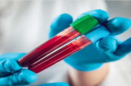 Indian Startup Develops AI-based Blood Test To Detect 32 Cancers Early ...