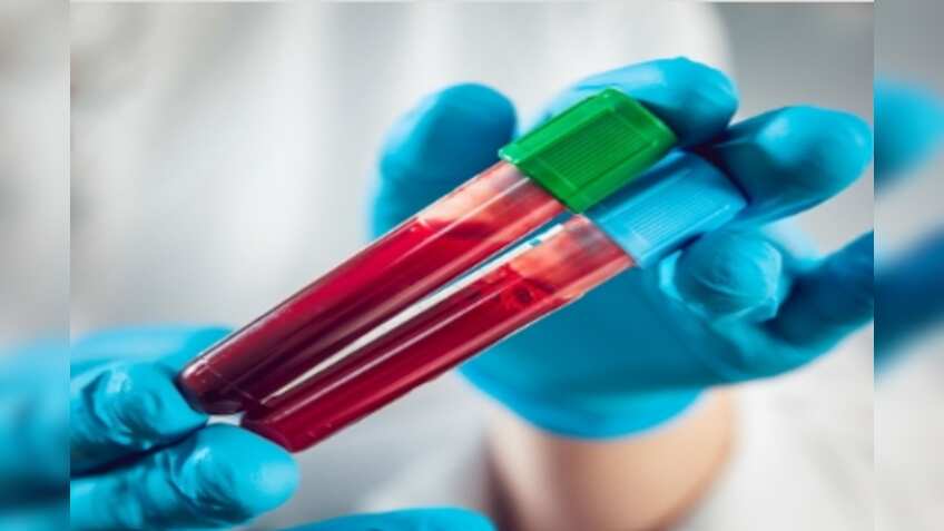 Indian startup develops AI-based blood test to detect 32 cancers early