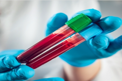 Indian startup develops AI-based blood test to detect 32 cancers early