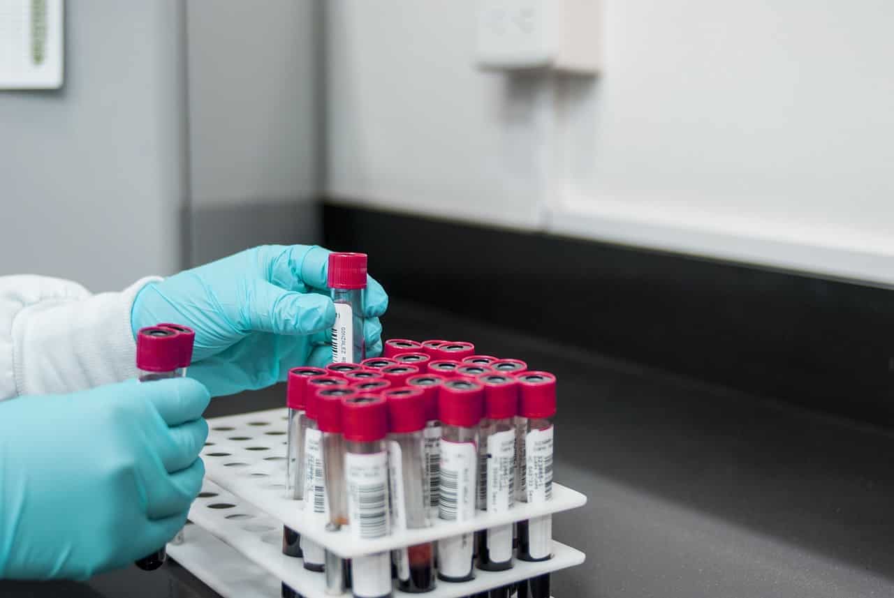 New blood test that can detect 50 different types of cancer shows progress