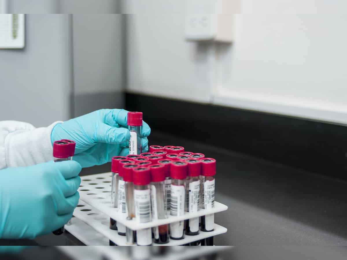 New blood test that can detect 50 different types of cancer shows progress