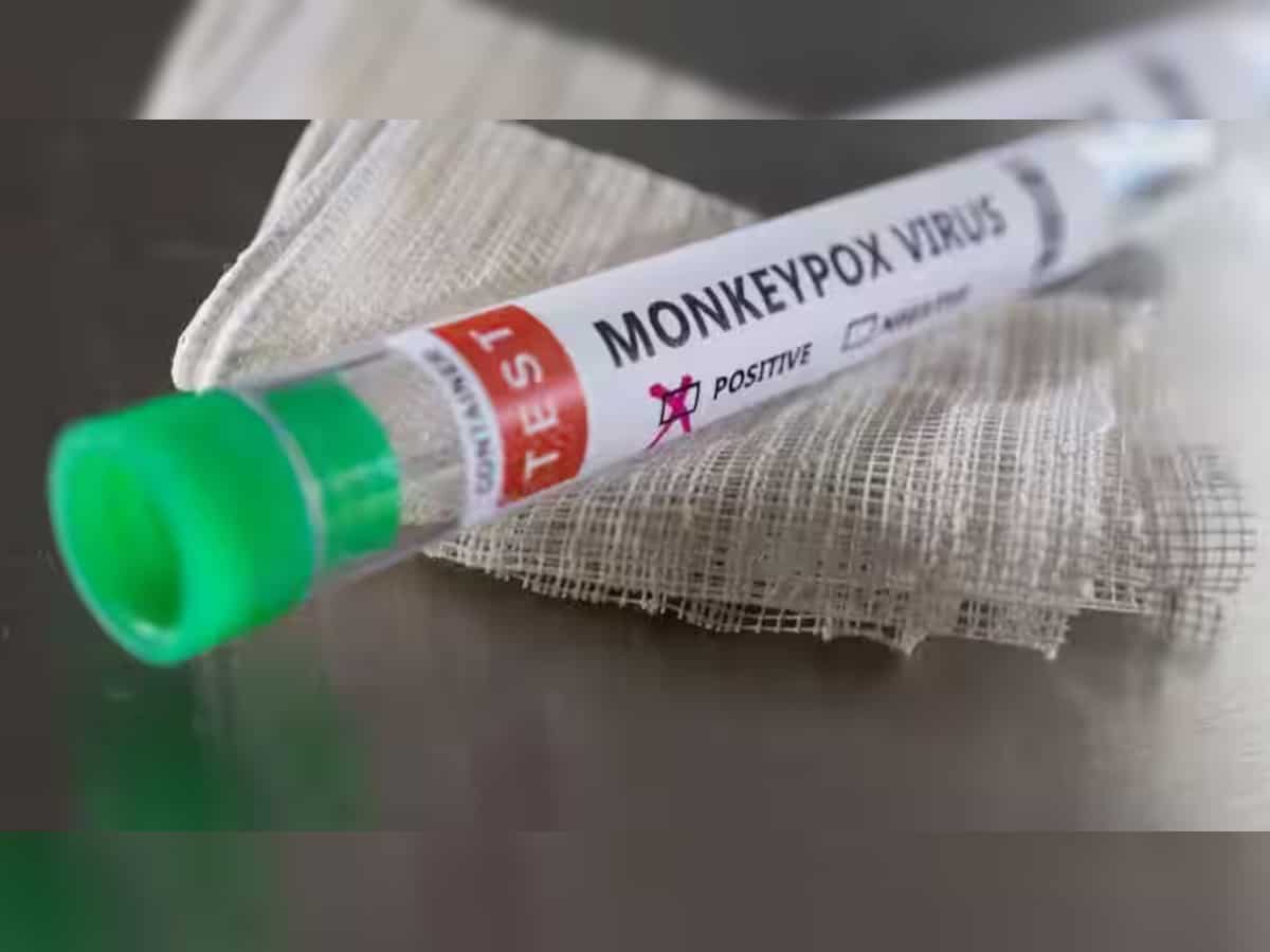 Israel detects 1st monkeypox case in 2023