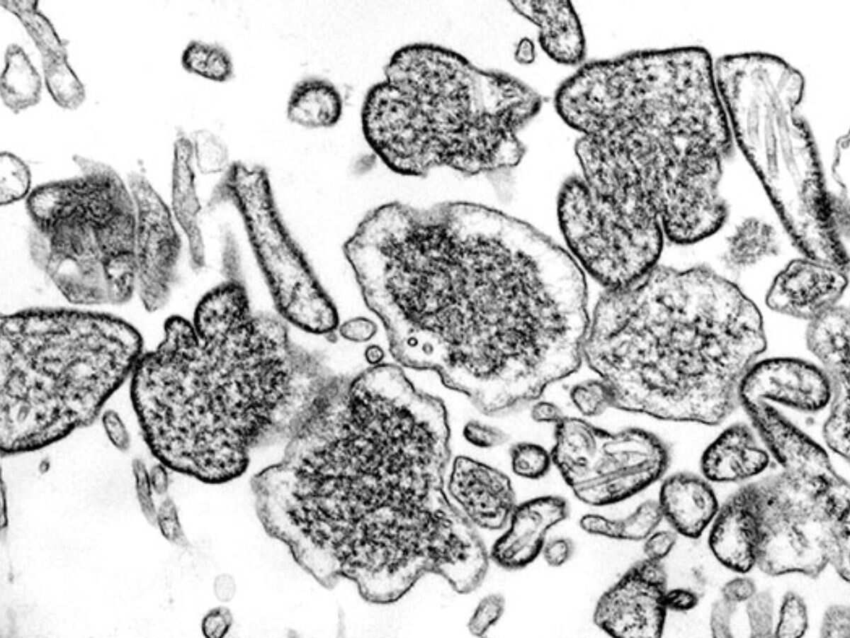 Nipah kerala govt strengthens measures to prevent spread of virus