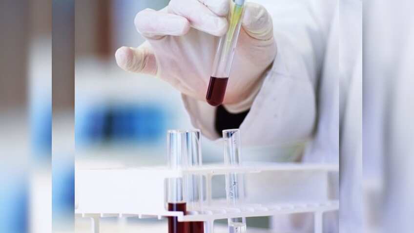 Alkem Labs share price target: Brokerages trim target price post-Q4 results; what should investors do?