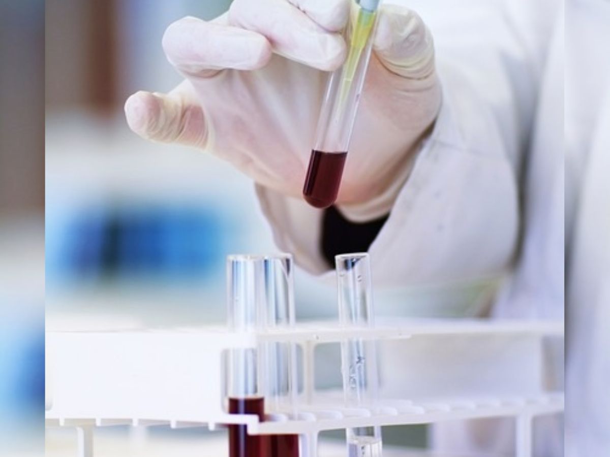 Alkem Labs share price target: Brokerages trim target