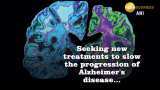 Hypertension drug may help Alzheimer's patients Hypertension drug may help Alzheimer's patients
