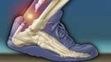 How to keep bones, joints healthy How to keep bones, joints healthy