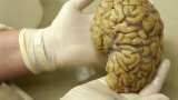 Continuous vigilance may form memories via different brain process: Study Continuous vigilance may form memories via different brain process: Study
