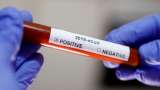 Coronavirus outbreak in China: Alert! Effect in India and what Modi government is doing Coronavirus outbreak in China: Alert! Effect in India and what Modi government is doing