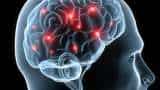 Your brain: Time of day linked to decrease in activity in specific regions, says study